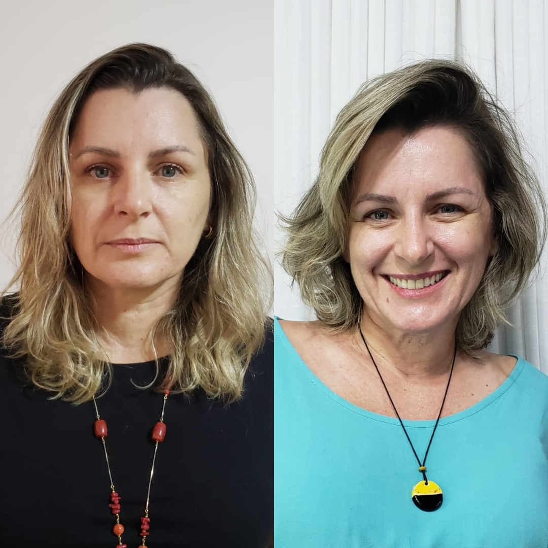 Comparação de imagem 9