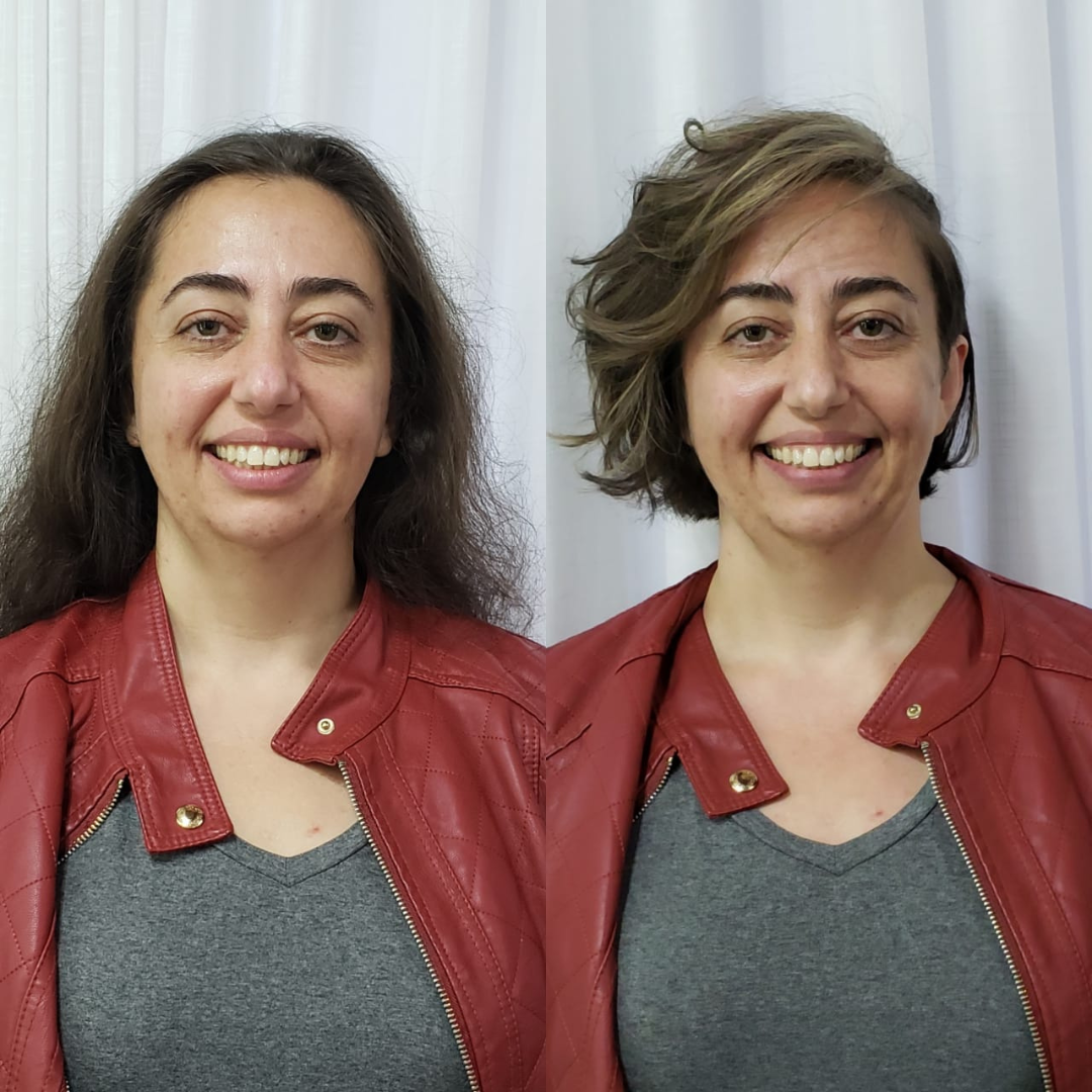 Comparação de imagem 11