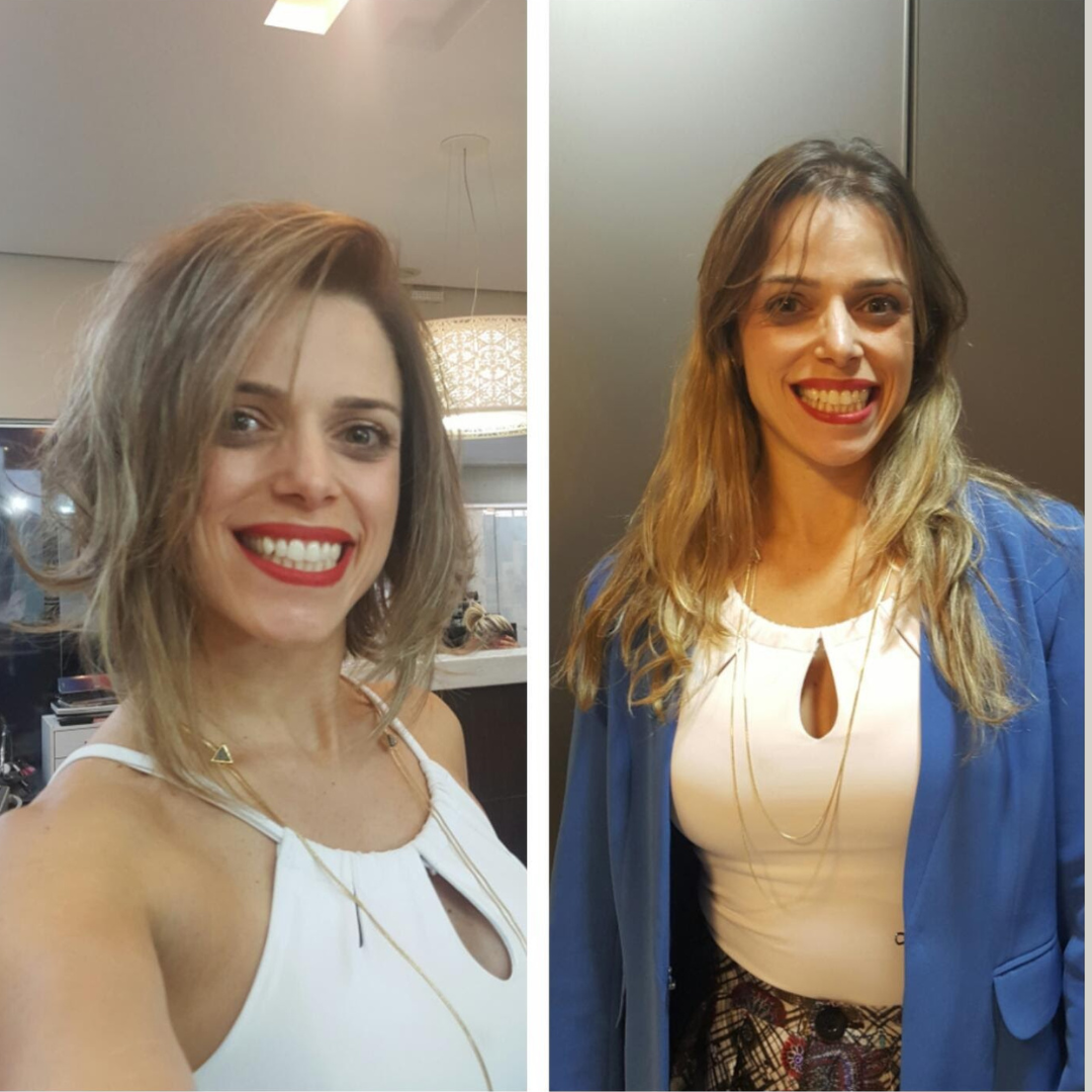Comparação de imagem 13
