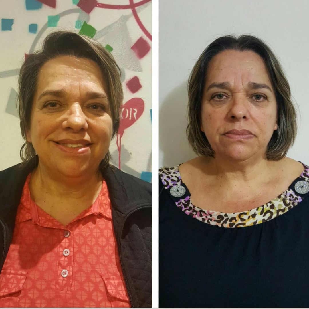 Comparação de imagem 14