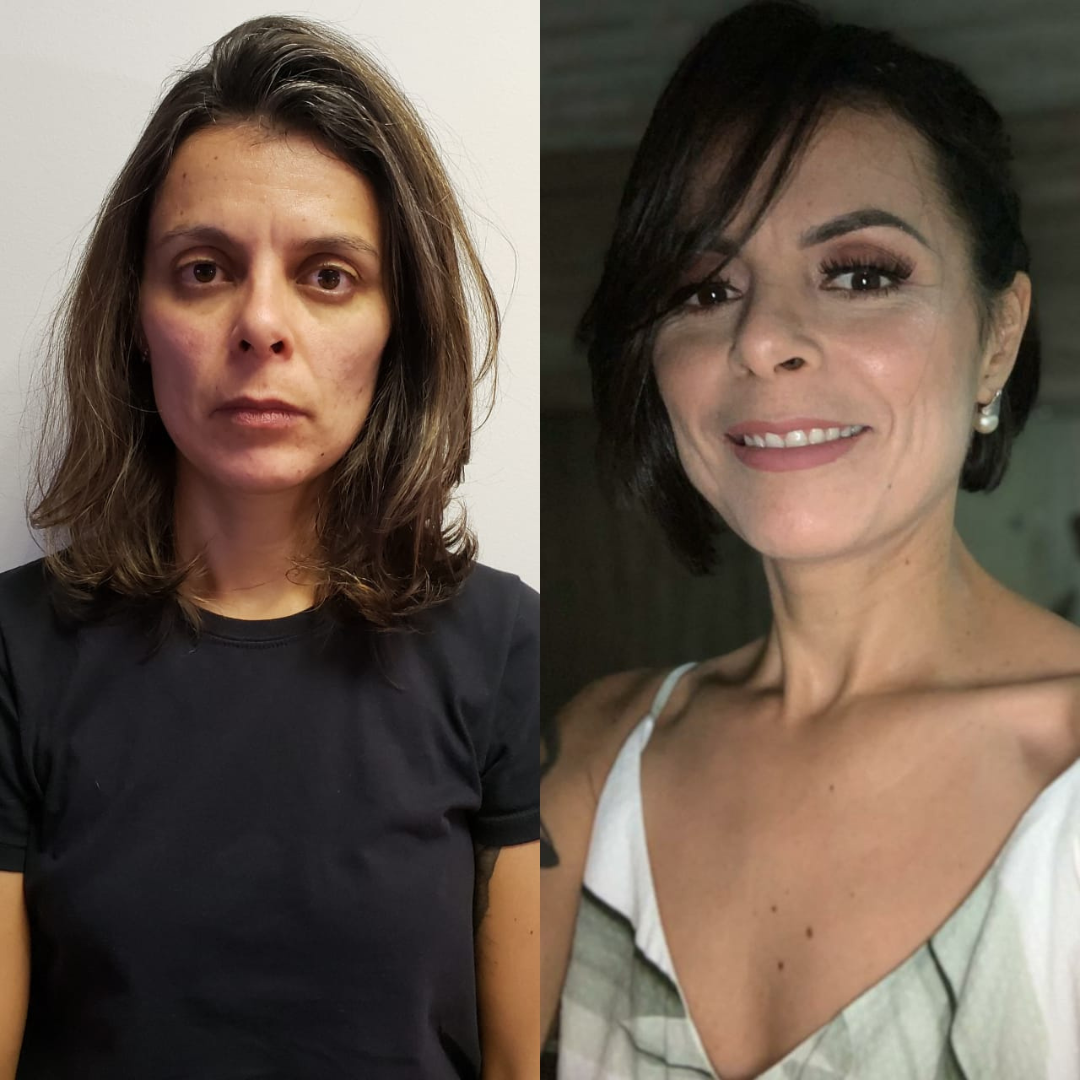 Comparação de imagem 17
