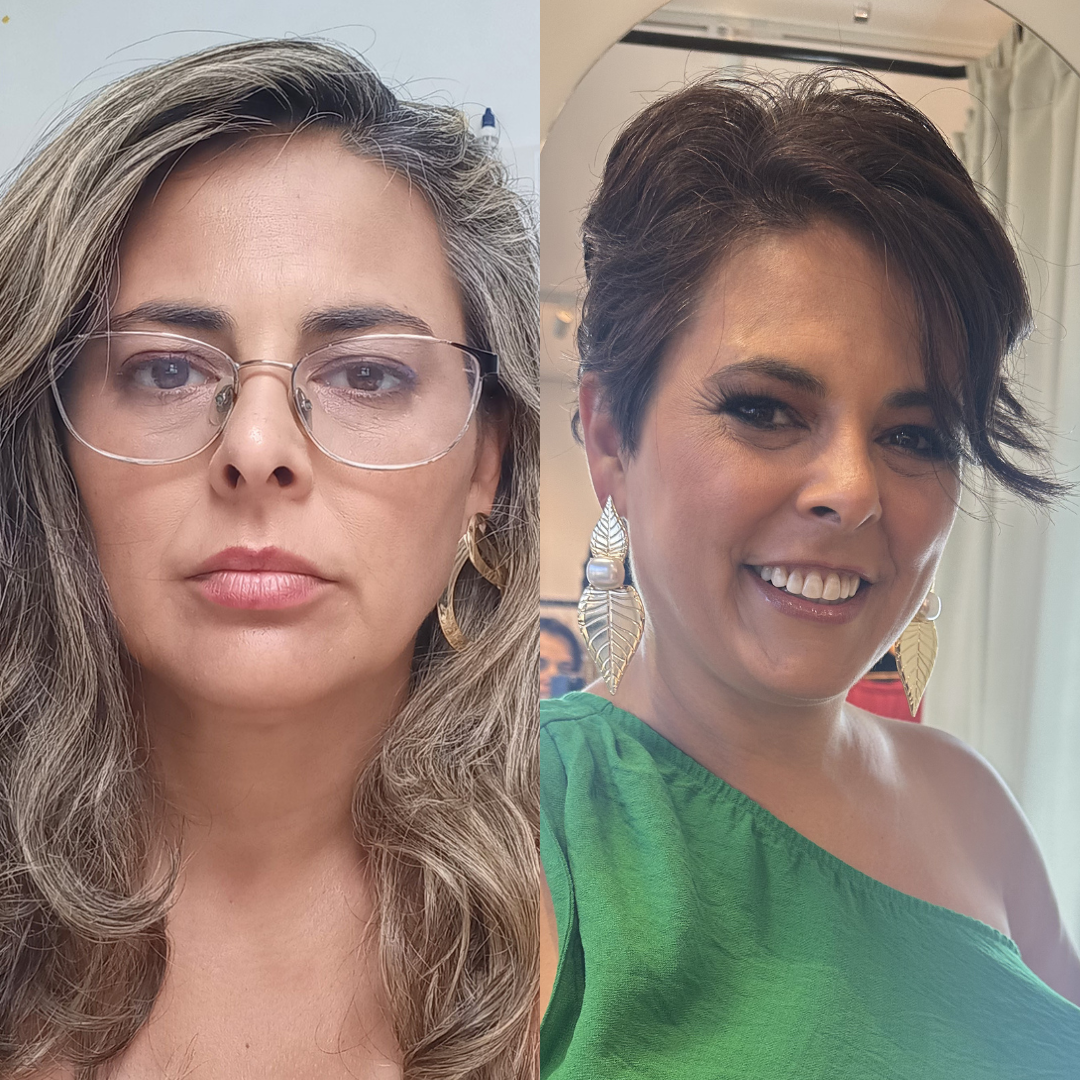 Comparação de imagem 18